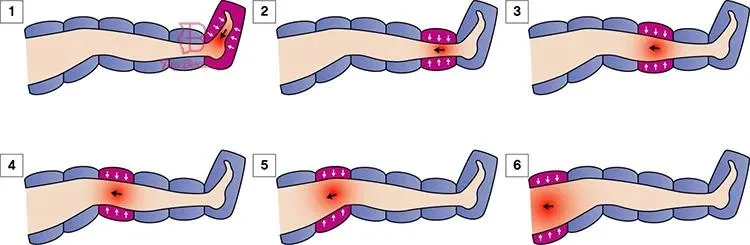 Pressotherapy Pneumatic Sports Dvt Pump Recovery Boots Lymph Circulation Leg Massager